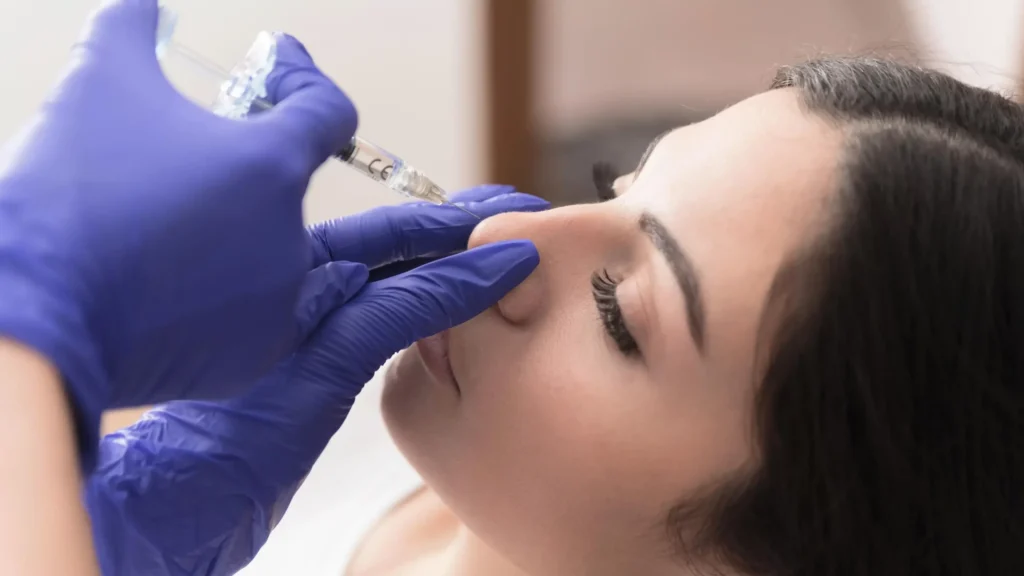 Nose Fillers