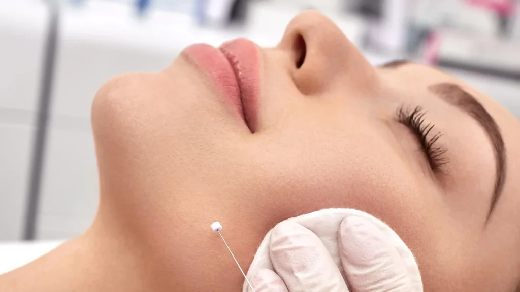 Thread Face Lift